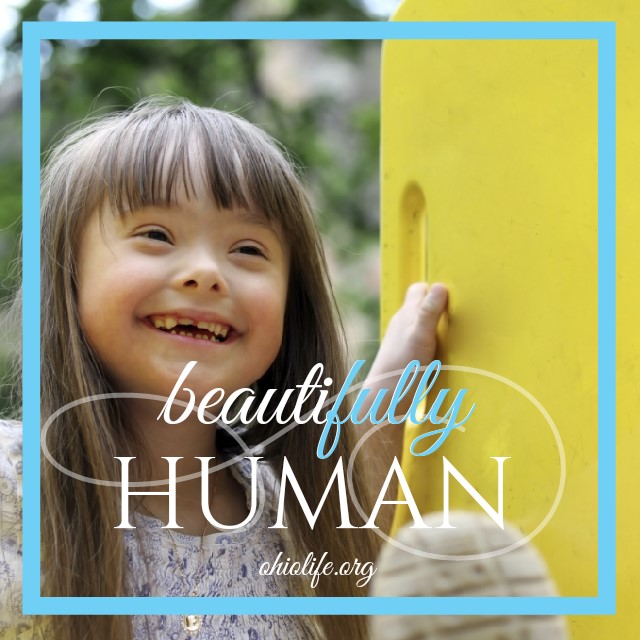 6-3-15_Beautifully_Human_Down_Syndrome.jpg