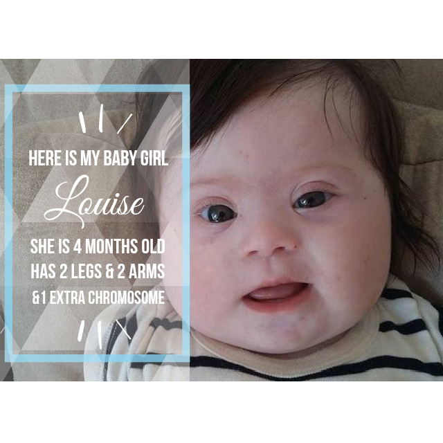 FB_-_6-11-15_Baby_Girl_Louise_with_Down_syndrome.png